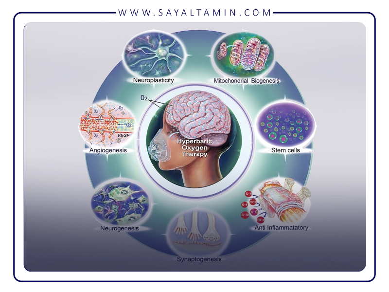 Benefits of using pure oxygen in hyperbaric conditions